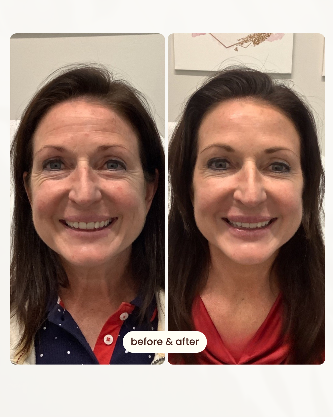 Before and after comparison 2