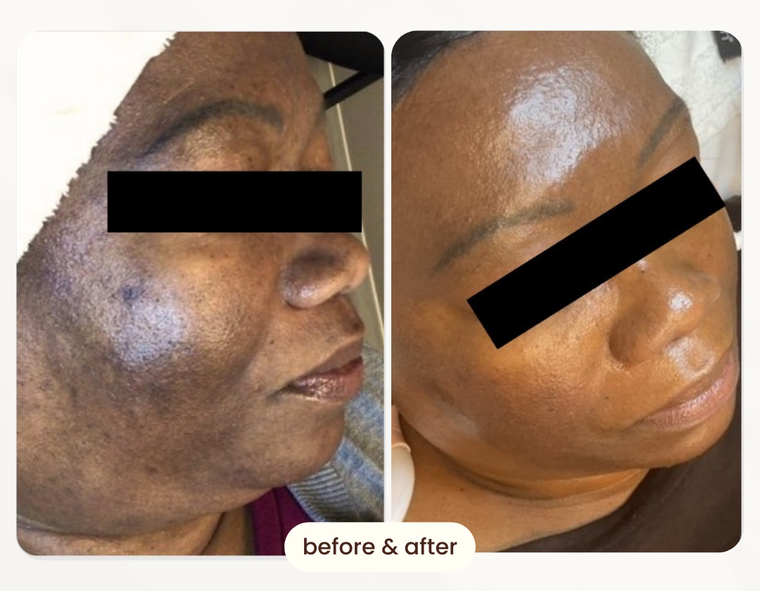 Before and after comparison 4