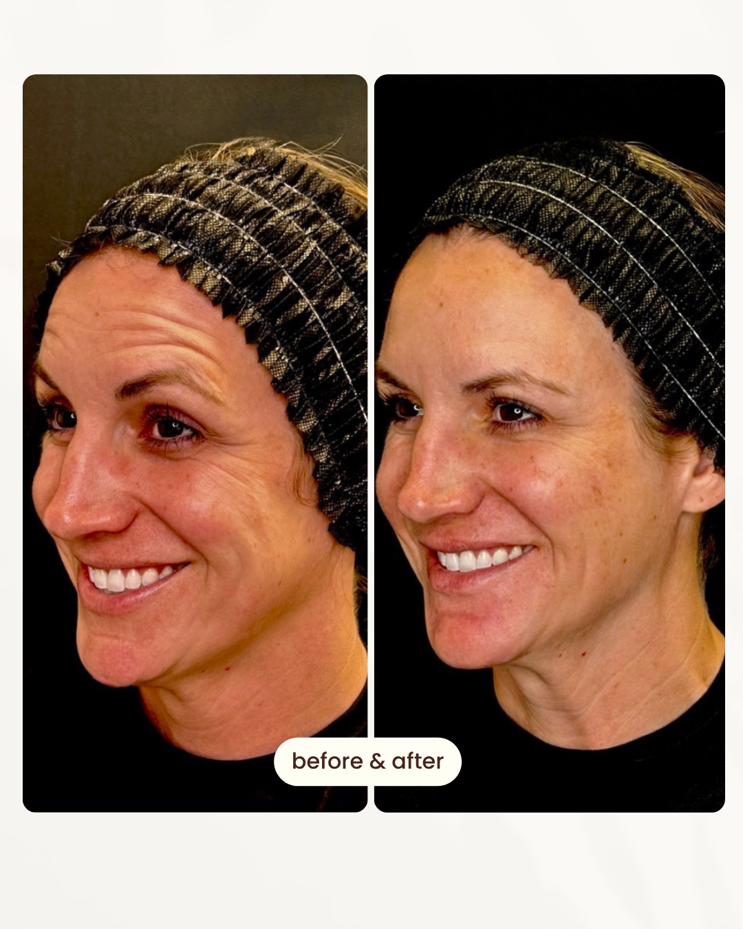 Before and after comparison 1