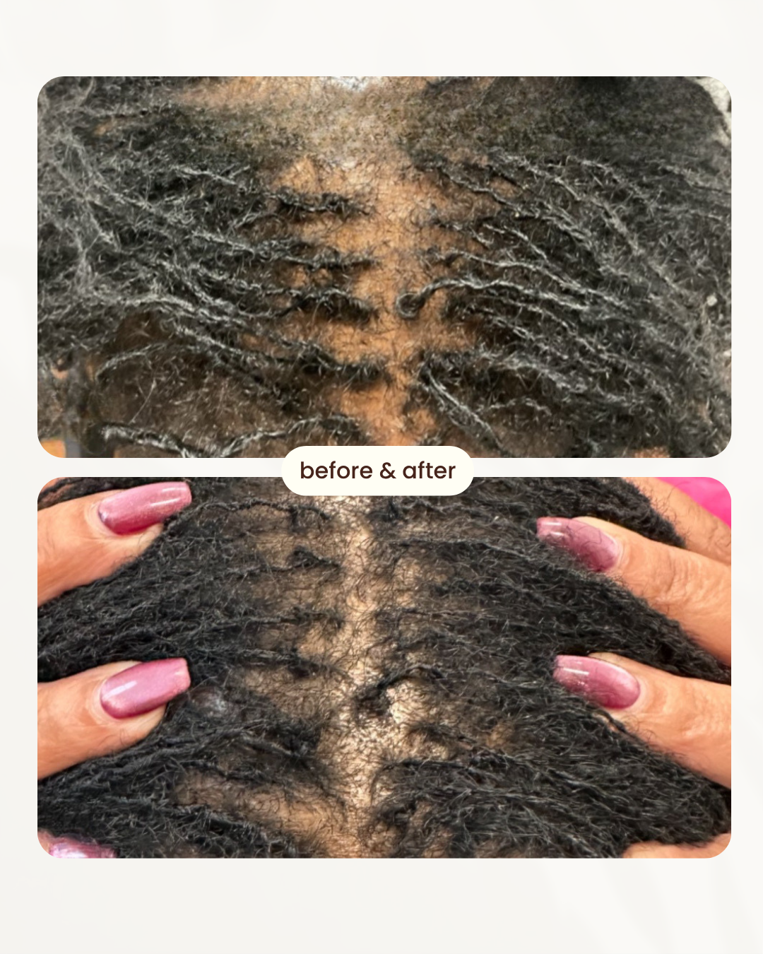 Before and after comparison 8