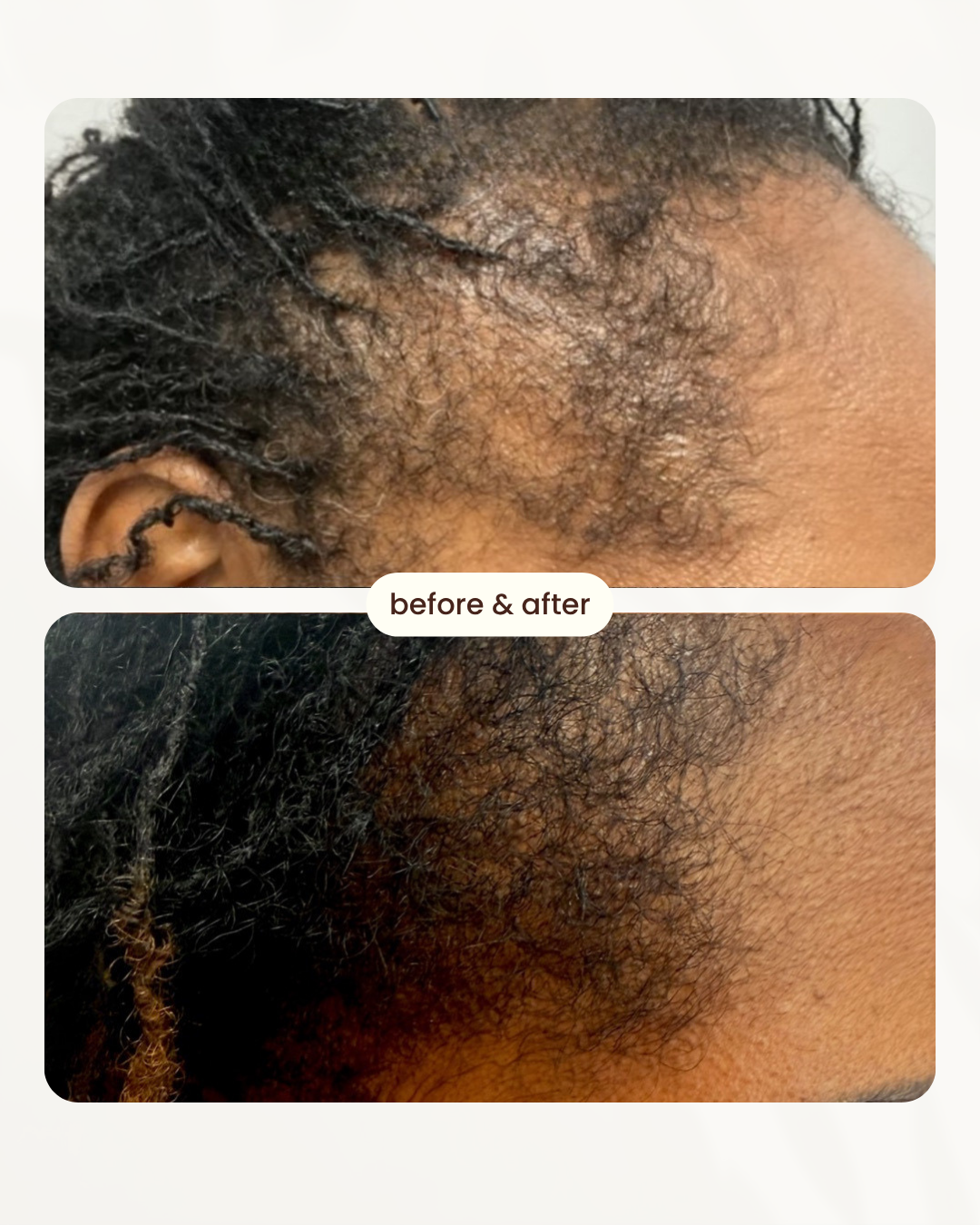 Before and after comparison 7