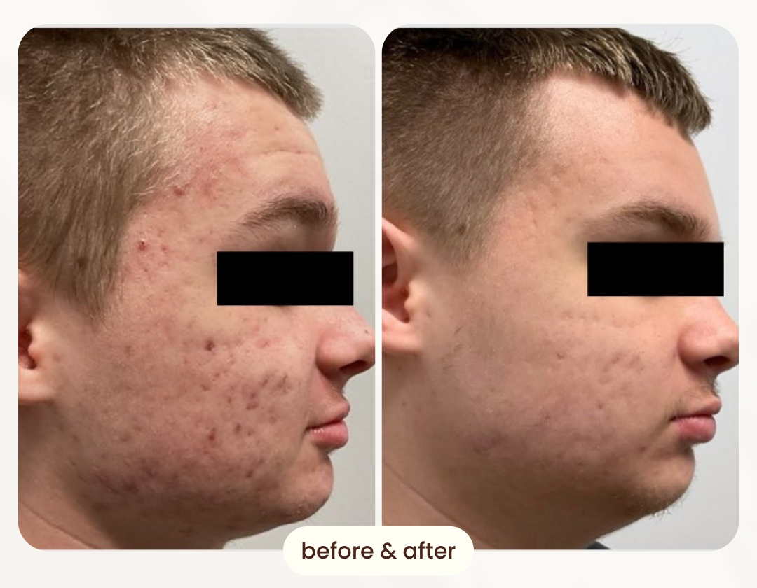 Before and after comparison 3