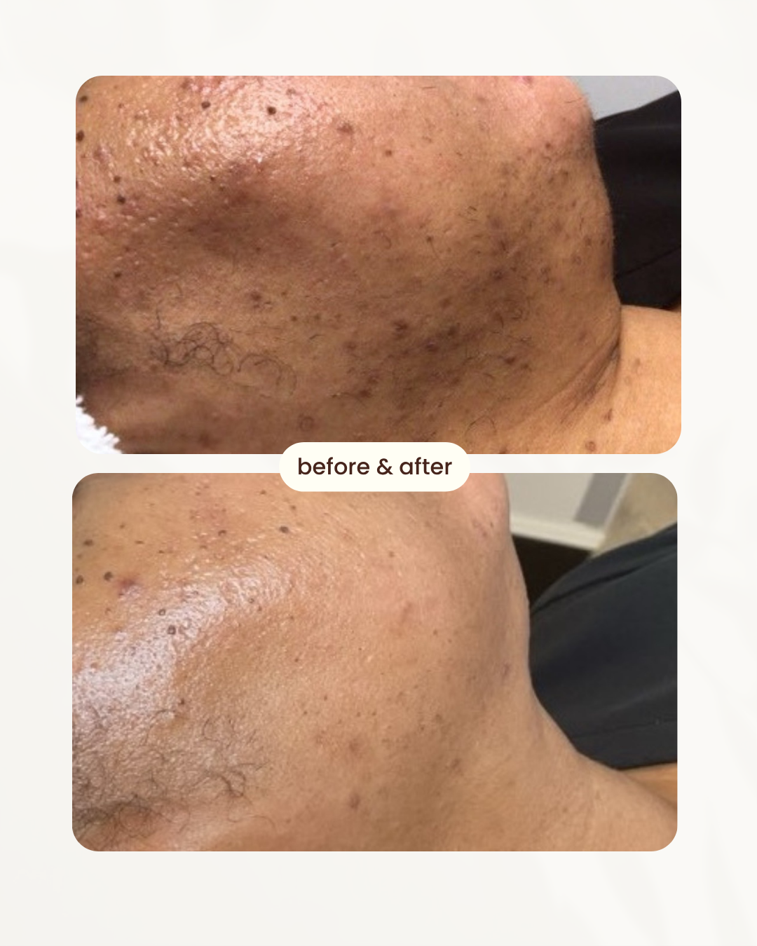 Before and after comparison 5